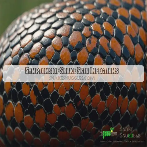 Symptoms of Snake Skin Infections