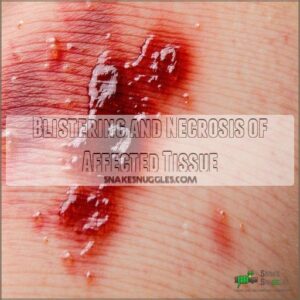 Blistering and Necrosis of Affected Tissue