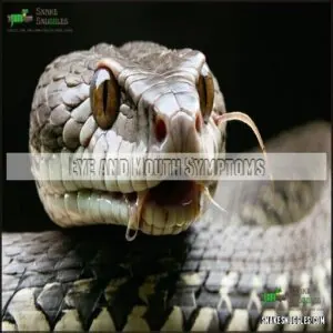 Eye and Mouth Symptoms Eye and Mouth Symptoms