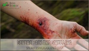 severe pain and swelling