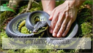 abdominal swelling