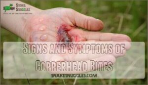 signs and symptoms of copperhead bites