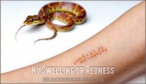 no swelling or redness
