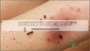 documented human cases