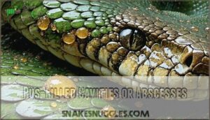 pus-filled cavities or abscesses