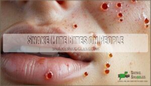 snake mite bites on people