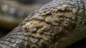 crusted or ulcerated scales crusted or ulcerated scales