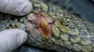 bacterial and fungal infections bacterial and fungal infections